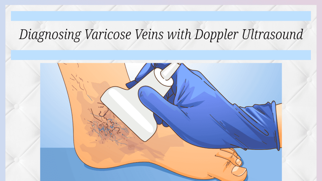 Doppler ultrasound being used to diagnose varicose veins.