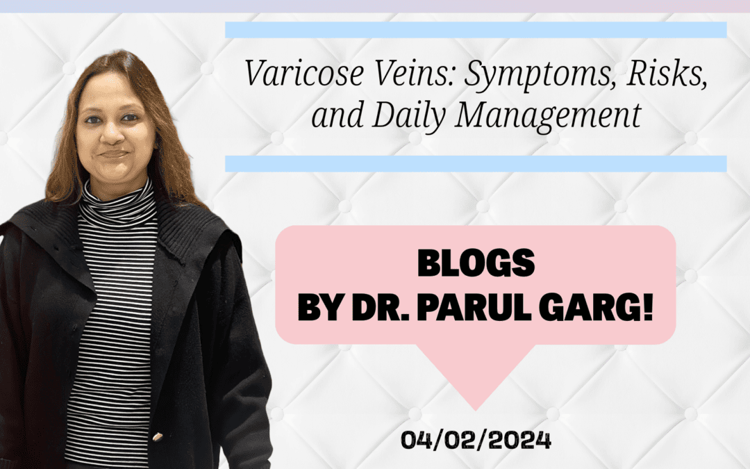 Dr. Parul Garg presents a blog on Varicose Veins: Symptoms, Risks, and Daily Management.