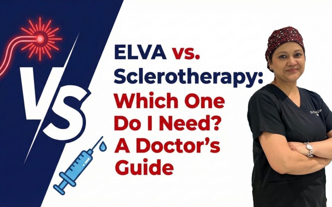 EVLA vs. Sclerotherapy: Which One Do I Need? A Doctor’s Guide