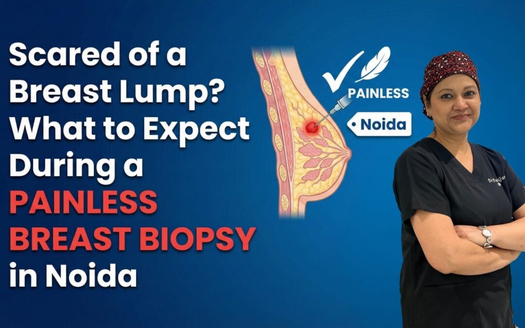 Scared of a Breast Lump? What to Expect During a Painless Breast Biopsy in Noida