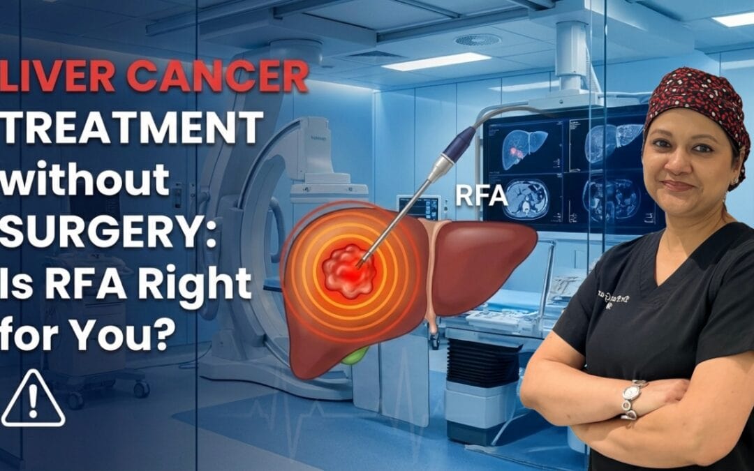 Liver Cancer Treatment Without Surgery: Is Microwave/Radiofrequency Ablation (RFA) Right for You?