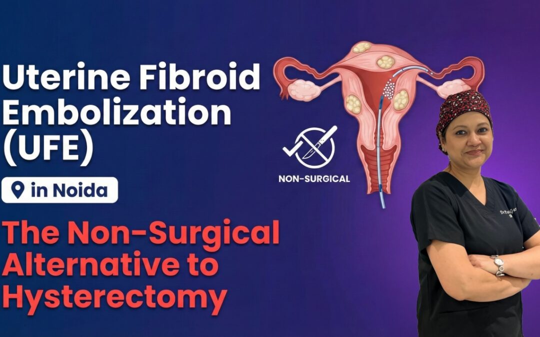 Uterine Fibroid Embolization (UFE) in Noida: The Non-Surgical Alternative to Hysterectomy